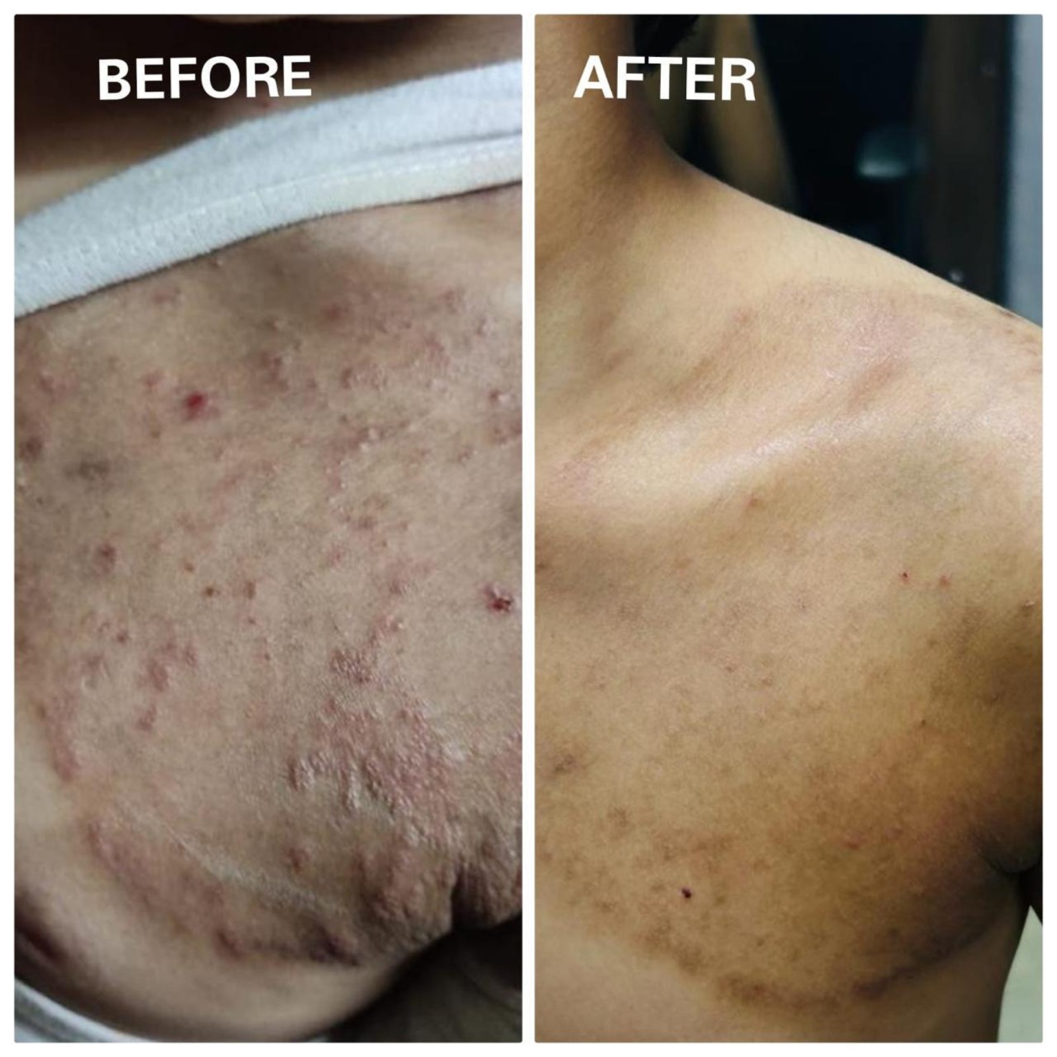 Pigmentation Correction